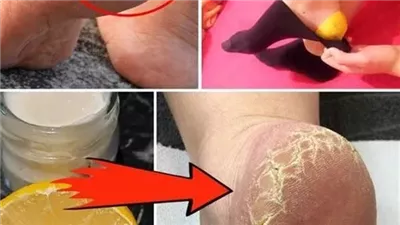 فوائد تدليك القدمين قبل النوم ستجعلك تحرص على هذه العادة يومياً